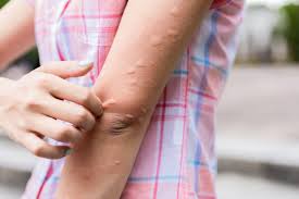 dermatologist rajshahi popular